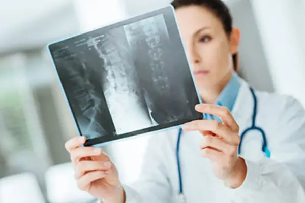 A doctor reviews x-rays of a car accident victim who sustained injuries to the neck and spinal cord