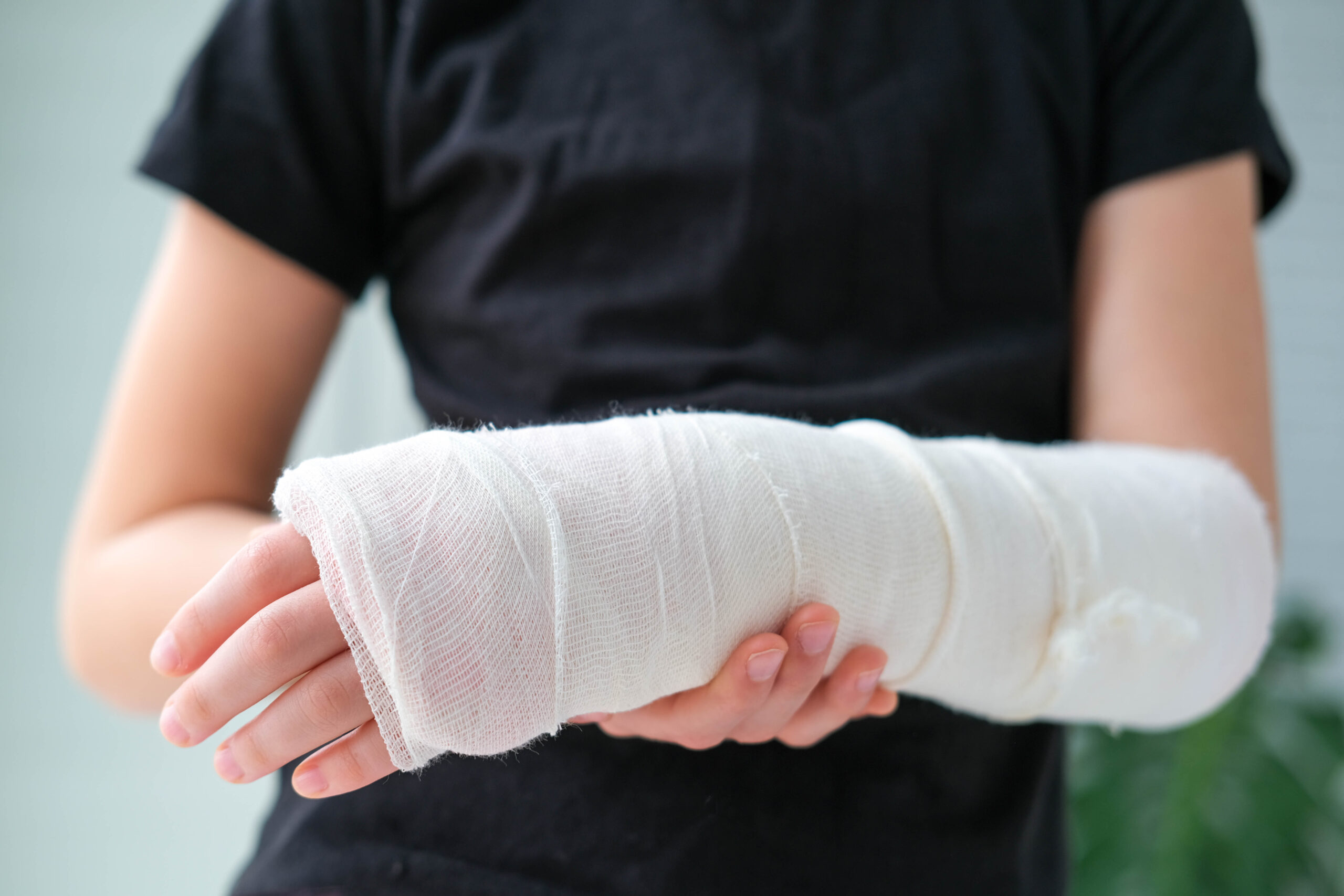 A child holds their wrapped left arm that is bandaged after a burn injury.